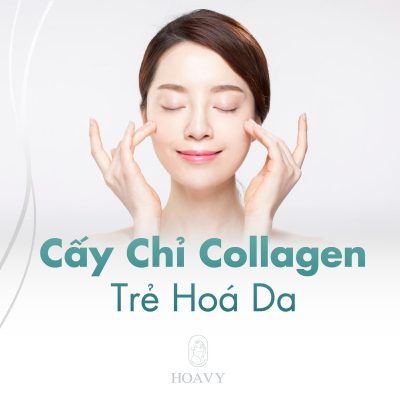 cấy chỉ collagen