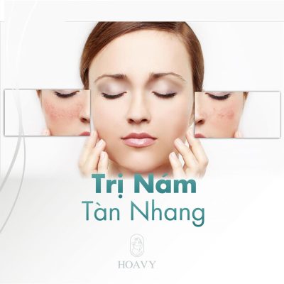 trị nám hải phòng