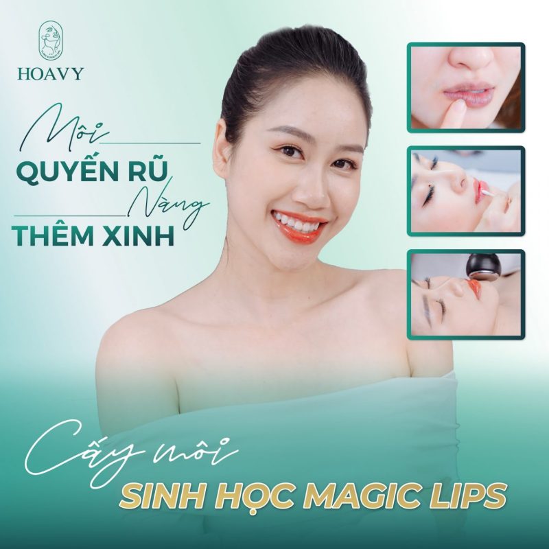 Cấy môi tại Hải Phòng - cấy môi sinh học Magic Lips là phương pháp chỉ tác động nhẹ trên bề mặt môi giúp sắc tố đôi môi trở nên tươi trẻ và rạng rỡ