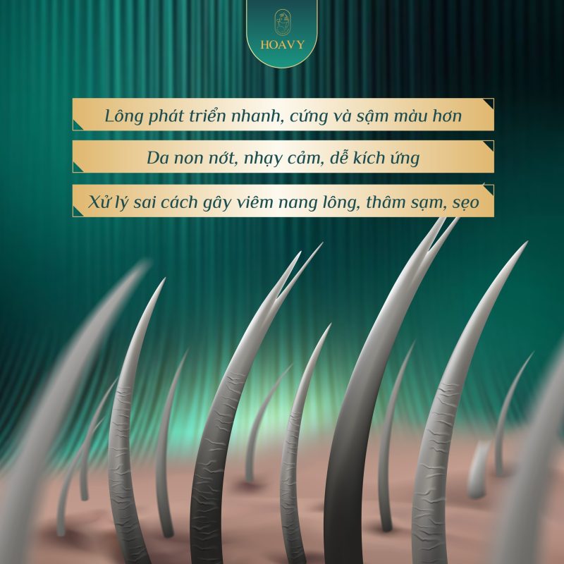 Vì sao triệt lông tuổi dậy thì cần công nghệ riêng biệt?