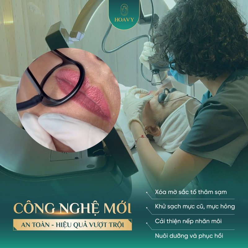 Công nghệ Laser CO2 Fractional tại HoaVy – phương pháp khử thâm môi hiện đại, an toàn và hiệu quả vượt trội