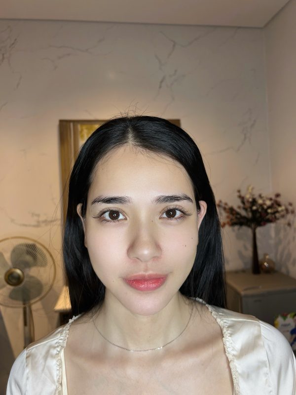 Cân chỉnh mặt Hải Phòng Fullface Baby phong thủy – Gương mặt hài hòa, hợp tướng số 3 khách hàng trước và sau khi cân chỉnh mặt tại HoaVy