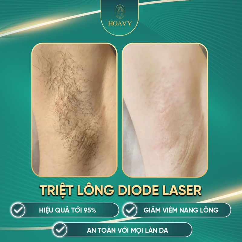 Triet long cong nghe cao tai Hai Phong lan da min mang khong tai moc