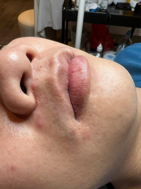 voi dich vu khu tham moi tai TMV HOAVY ban se nhanh chong so huu bo moi hong hao cang muot tu nhien ma khong lo dau rat hay ton thuong