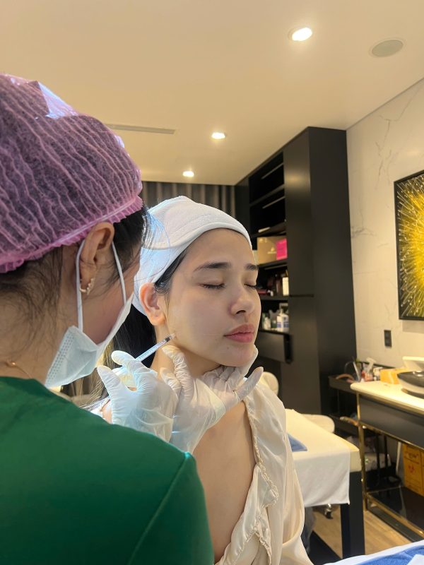 Cân chỉnh mặt Hải Phòng Fullface Baby phong thủy – Gương mặt hài hòa, hợp tướng số 2 Khách hàng tại TMV Hoa Vy được các chuyên viên tại TMV Hoa Vy tư vấn, thực hiện quy trình cân chỉnh mặt chuẩn khoa học và phong thủy.