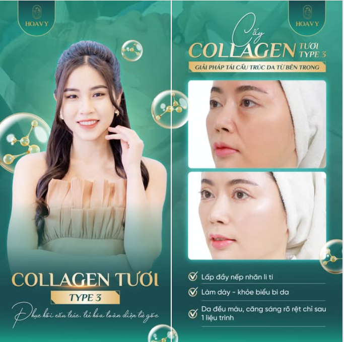 Kết hợp sử dụng serum cùng liệu trình trẻ hóa Collagen tại TMV Hoa Vy để đẩy nhanh quá trình tái tạo, nâng cơ và cải thiện cấu trúc da hiệu quả gấp nhiều lần so với sử dụng đơn lẻ.
