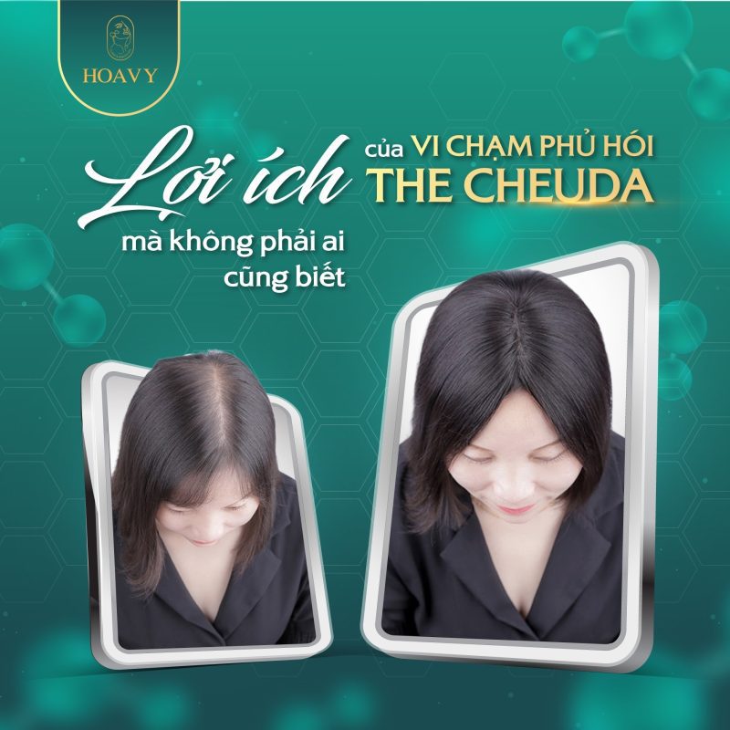 Công nghệ vi chạm SMP Biotin Extra tái tạo tóc từ gốc đến ngọn