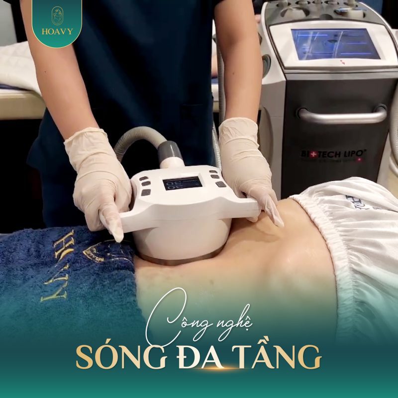 Sóng RF tấn công chính xác vào mô mỡ, hóa lỏng và đào thải tự nhiên qua tuyến bài tiết.