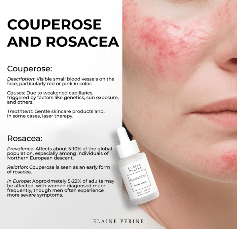 Serum giảm kích ứng cho da nhạy cảm Couperose Elaine Perine – Giải pháp làm dịu và phục hồi da yếu hiệu quả từ Đức 2 screenshot 1761120890
